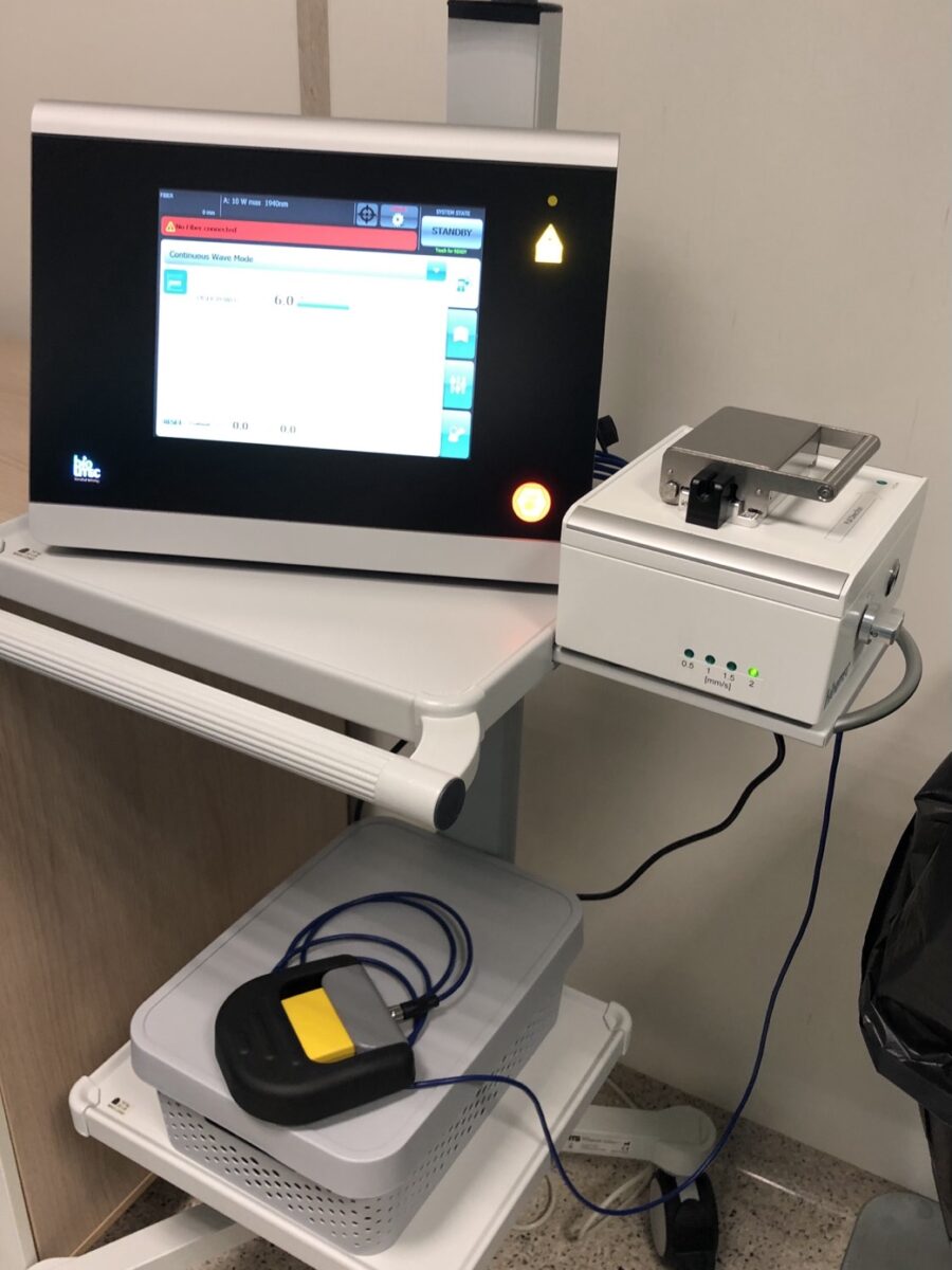 Лазерният апарат BIOLITEC с устройството за изтегляне на влакното и педала, в операционната на центъра
